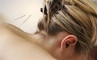 Kate Winstanley Acupuncture London   Harley St Clinic 727101 Image 2